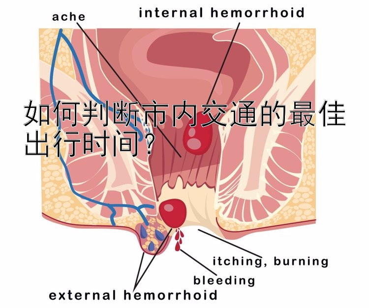 如何判断市内交通的最佳出行时间？