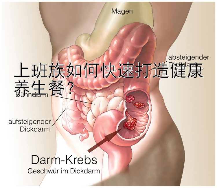 上班族如何快速打造健康养生餐？