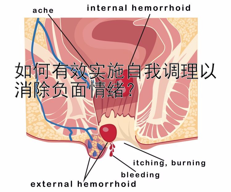 如何有效实施自我调理以消除负面情绪？