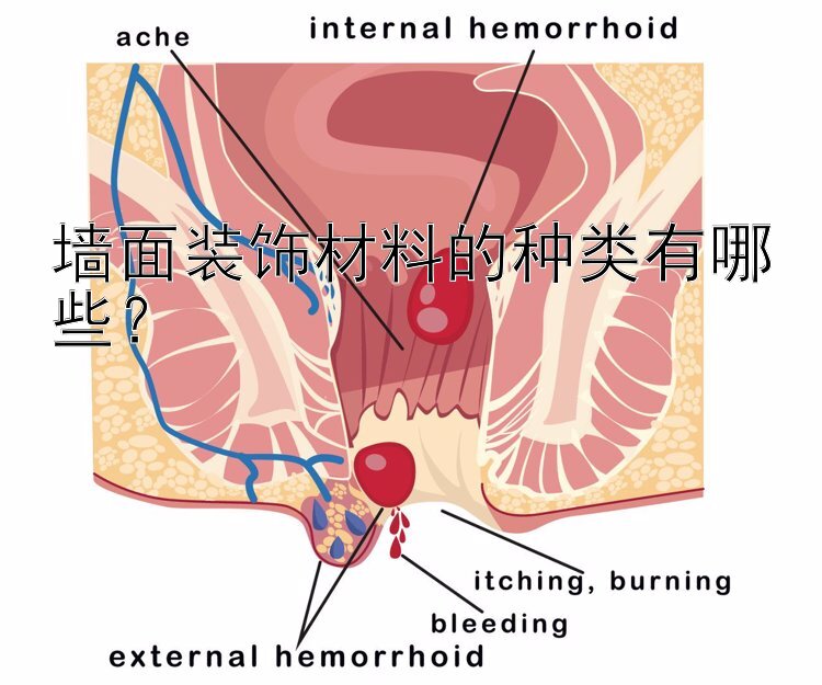 墙面装饰材料的种类有哪些？