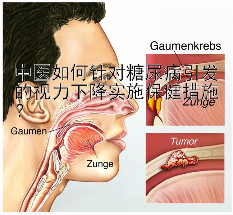 中医如何针对糖尿病引发的视力下降实施保健措施？