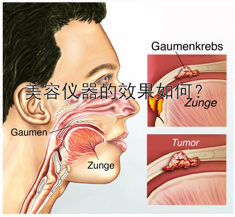 美容仪器的效果如何？