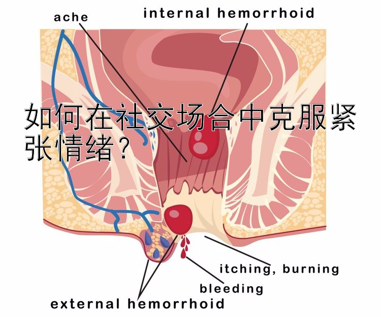 如何在社交场合中克服紧张情绪？