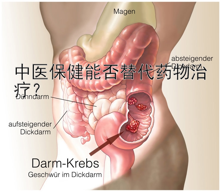 中医保健能否替代药物治疗？