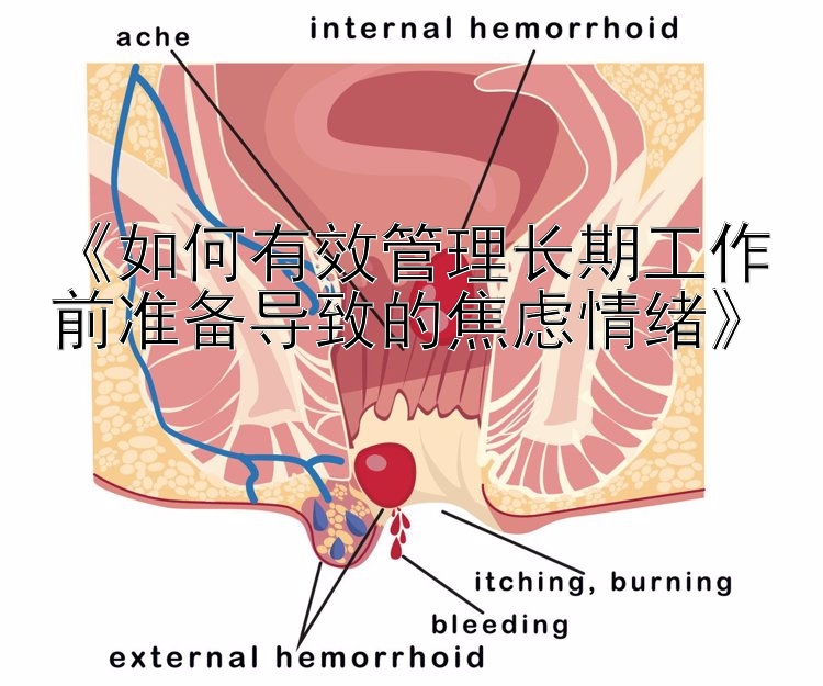 《如何有效管理长期工作前准备导致的焦虑情绪》