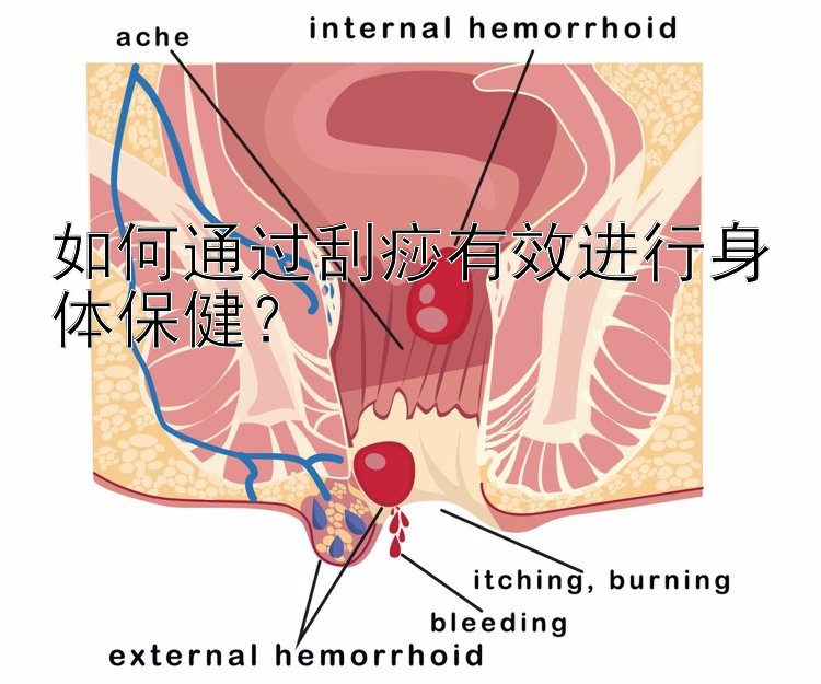 如何通过刮痧有效进行身体保健？