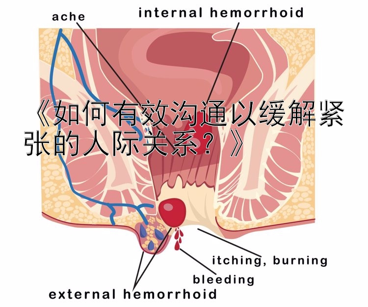 上海11选5预测《如何有效沟通以缓解紧张的人际关系？》