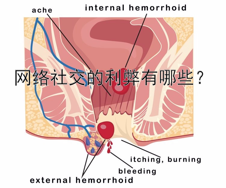 网络社交的利弊有哪些？