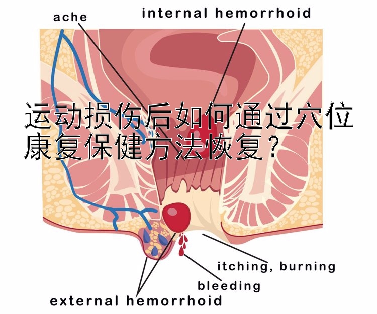 运动损伤后如何通过穴位康复保健方法恢复？